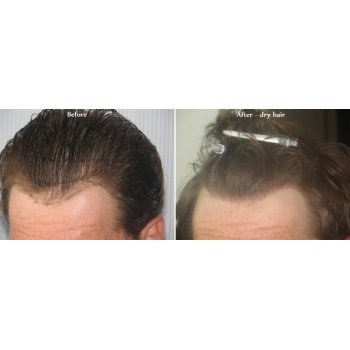 Before and after dry hairs  2